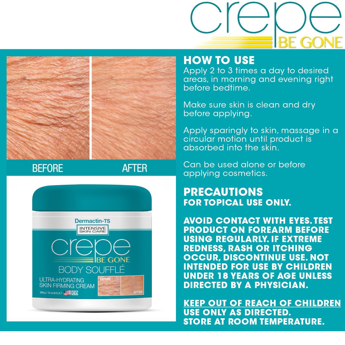Crepe Be Gone Body Souffle Classic - Large 12 ounce - Ultra Hydrating Crepe Skin Firming Cream for Neck,Chest, Arms & Legs