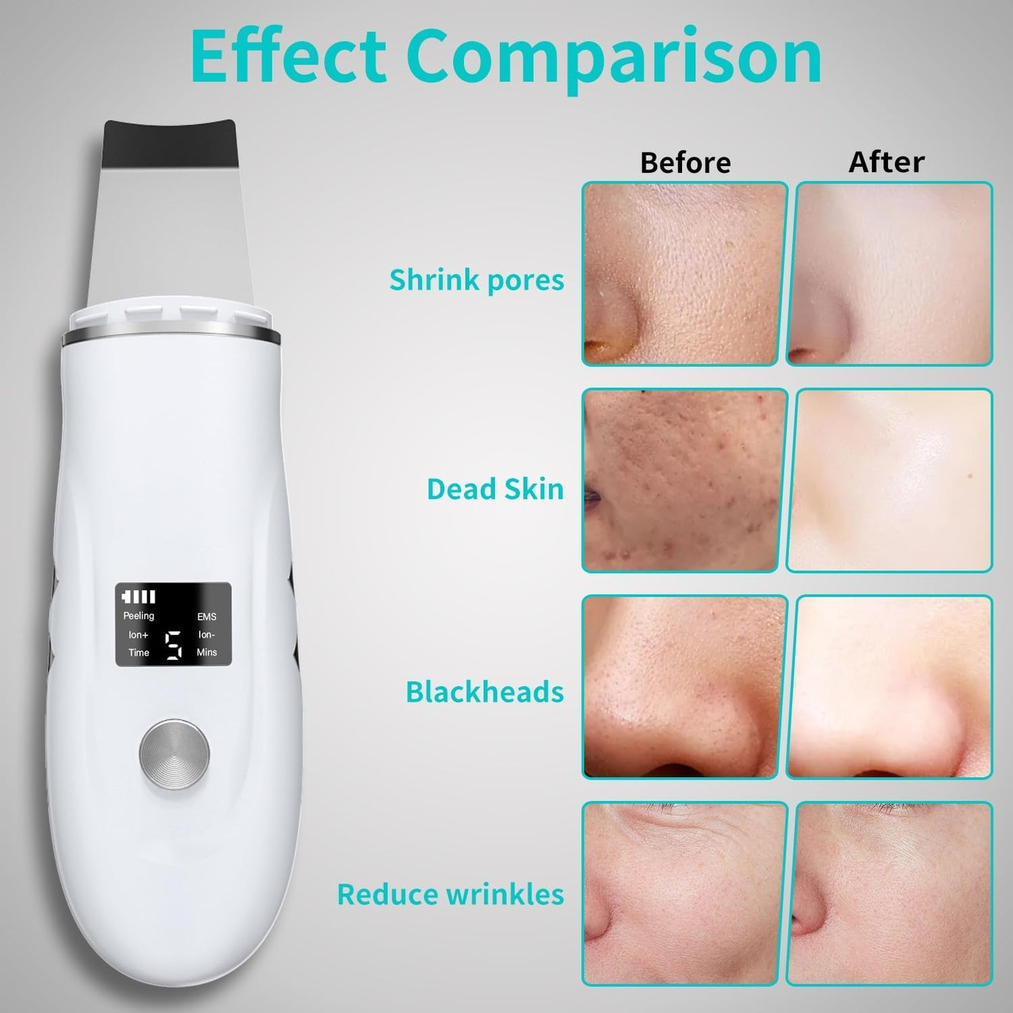 Face Scrubber Skin Spatula - Blackhead Remover Deep Cleansing Tool for Pore Extraction, 4-in-1 Fast Charging Dock Blackhead Remover Face Spatula for Facial Skincare Women Gift (White)