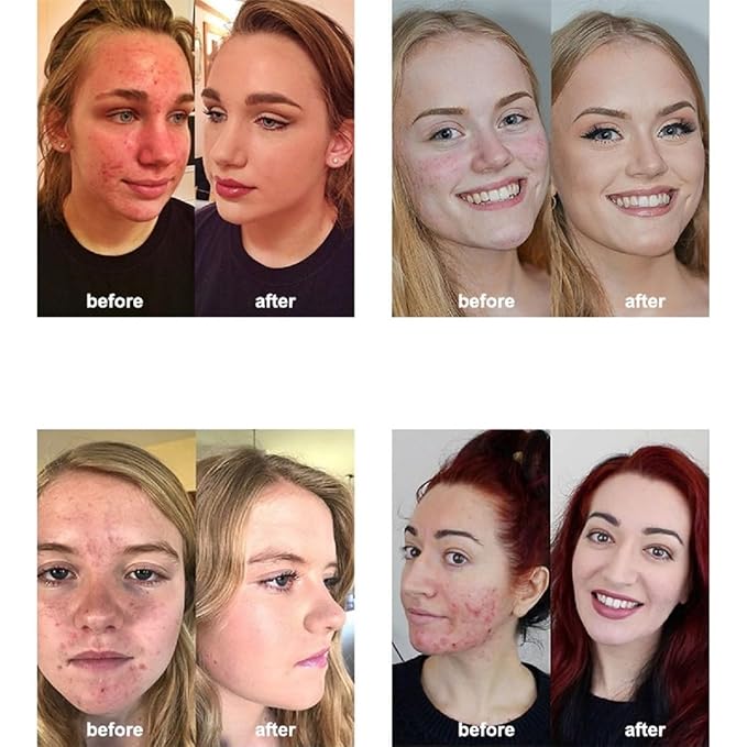 2 Pack PHOERA Foundation,Matte Oil Control Concealer Foundation Cream,PHOERA Long Lasting Waterproof Matte Liquid Foundation for Women Girls (102 Nude+104 Buff Beige)