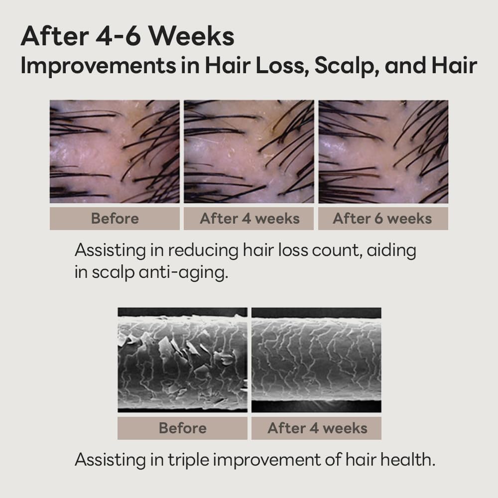 Scalp Intensive Shampoo with Biotin | Korean Shampoo for Hair Loss, Hair Regrowth, Thinning Hair, Volume Boost & Damage Repair (13.52 fl oz)