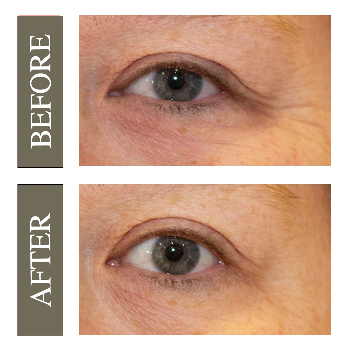 Hey Honey Open Your Eyes Lifting Eye Serum | Under Eye Cream for Dark Circles & Puffiness | Around The Eyes Hydration | Suitable For Sensitive Aging Skin | Delivers A Bright Rested look | 0.5 oz.