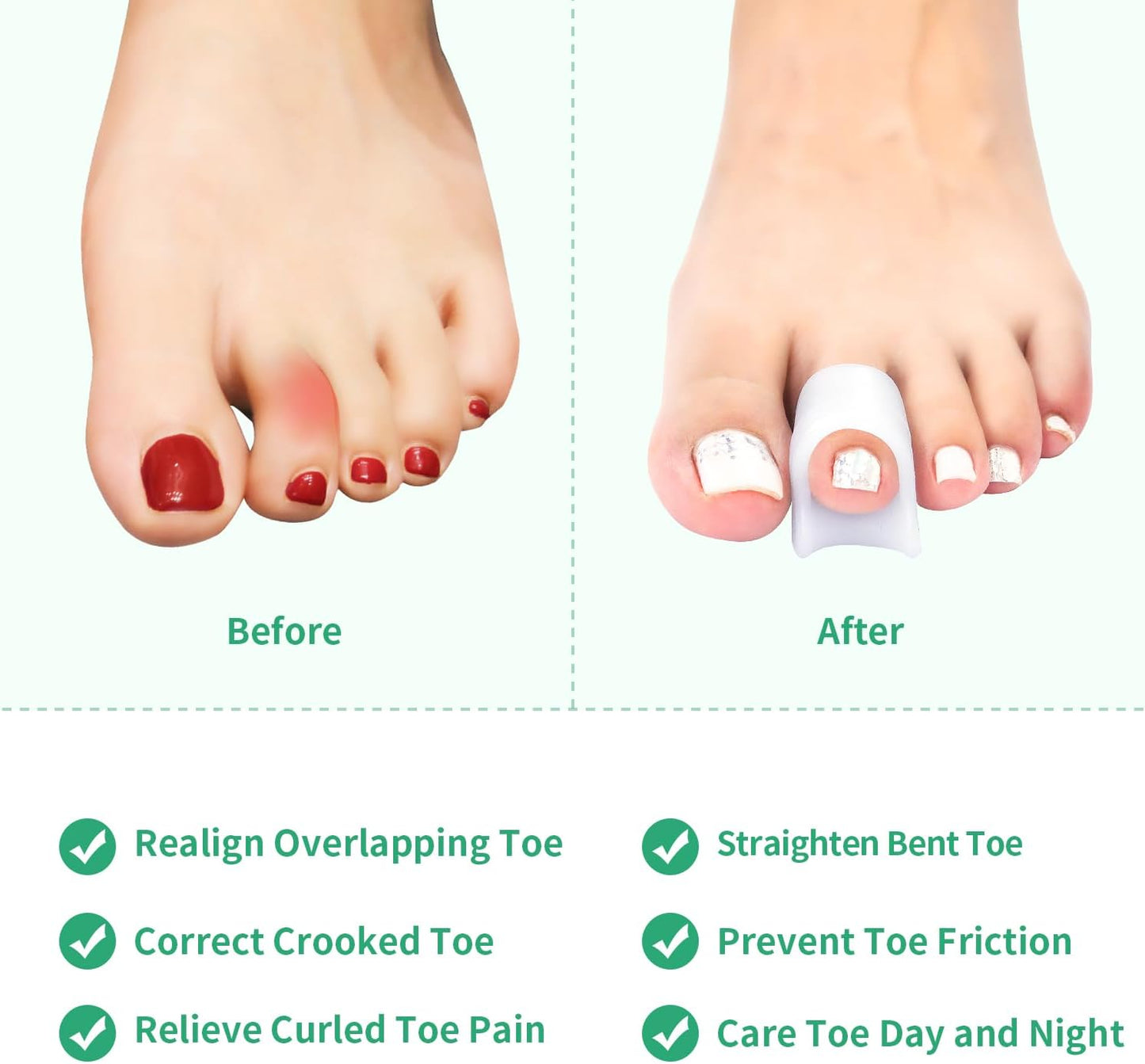 Niupiour Gel Hammer Toe Correctors - Bunion Corrector for Women and Men, 6 Pack of Silicone Toe Separators/Straighteners for Bent Toe, Toe Spacers for Correct Claw Toe, Curled Toe, Crooked Toe