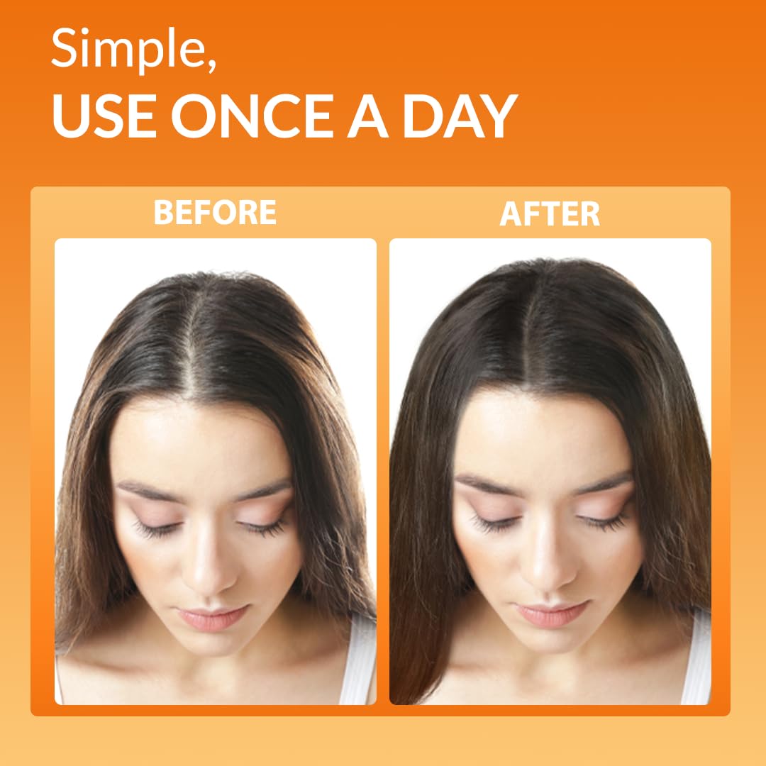 Youthfully Beautiful Rice Nutri Spray and Shampoo Bar Set Rice and Coffee Extract for Thinning Hair and Loss Hair Growth Support Natural Solid Cleanser Scalp Treatment Thickening Nourishing Care