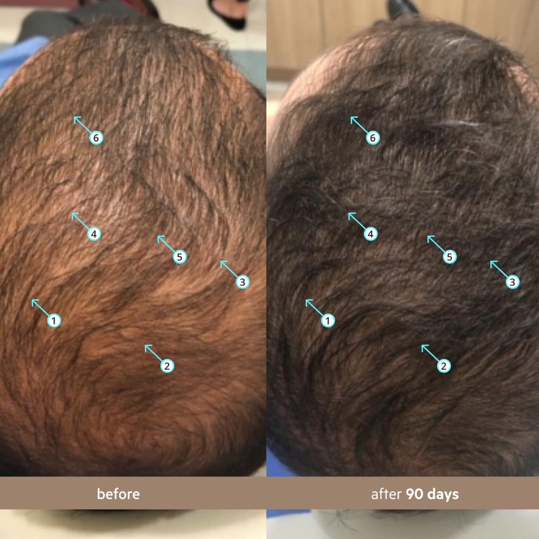 DS Labs Spectral Men’s Hair Density Serum (formerly Spectral.DNC-N), 60mL - Lightweight Leave-In for Fuller Looking, Thicker Looking Hair, Fast Absorbing, Non-Greasy, For All Hair Types