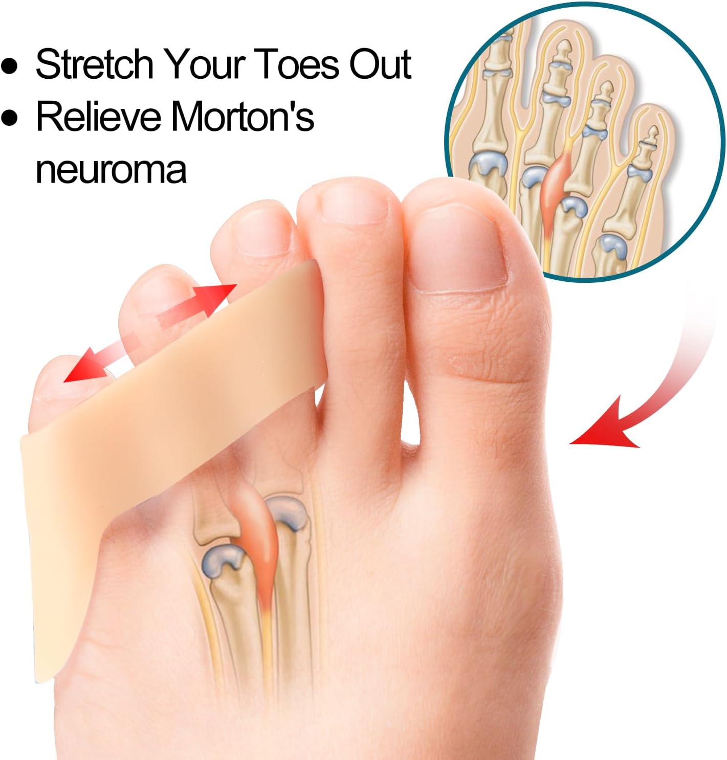 Povihome 10 Pack Pinky Toe Separator and Protectors, Triple Gel Toe Separators for Overlapping Toe, Curled Pinky Toes Separate and Protect (Beige)