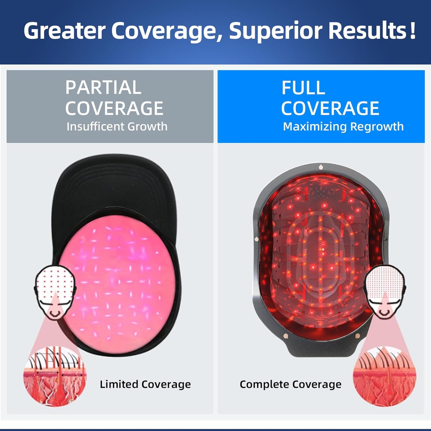 Laser Red Light Therapy for Hair Growth Device, FDA Cleared Hair Loss, Hair Growth Device