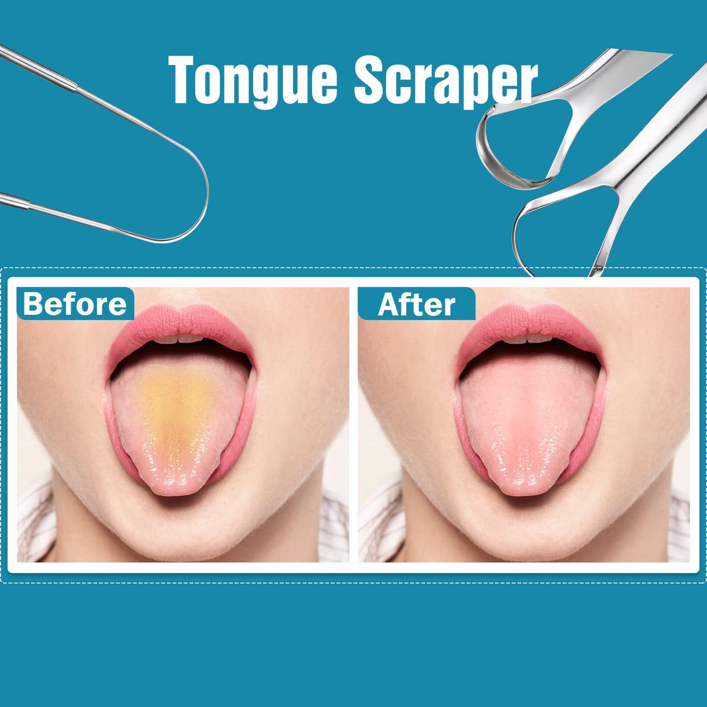 3 PCS Metal Tongue Scraper, Tongue Scrapers for Adults, Stainless Steel Tounge Scrappers, Tounge Scraper, Portable Tongue Scrappers YLYL