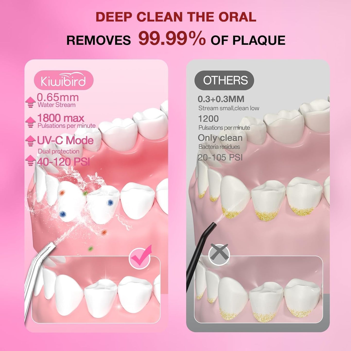 KIWIBIRD Water Dental Flosser with UV-C Sanitization, Cordless Oral Irrigator, 3 Modes & 4 Tips, 300ML BPA-Free Tank, 40-120PSI Portable Teeth Cleaner for Plaque, Home & Travel Use (Pink Ombre)