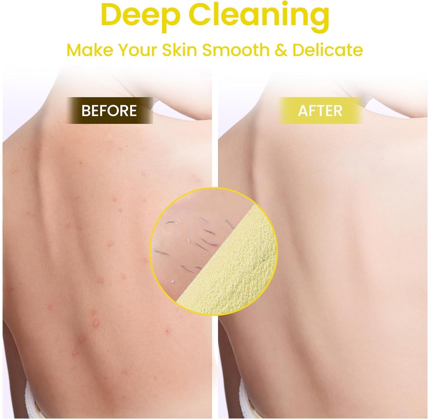 3 Pcs Double-Sided Back Exfoliator Body Scrub Towel, Exfoliating Back Scrubber with Handles,Exfoliating Washcloth Bath Tool in Shower, Stretchable Back Washer to Deep Cleans Skin (Beige)