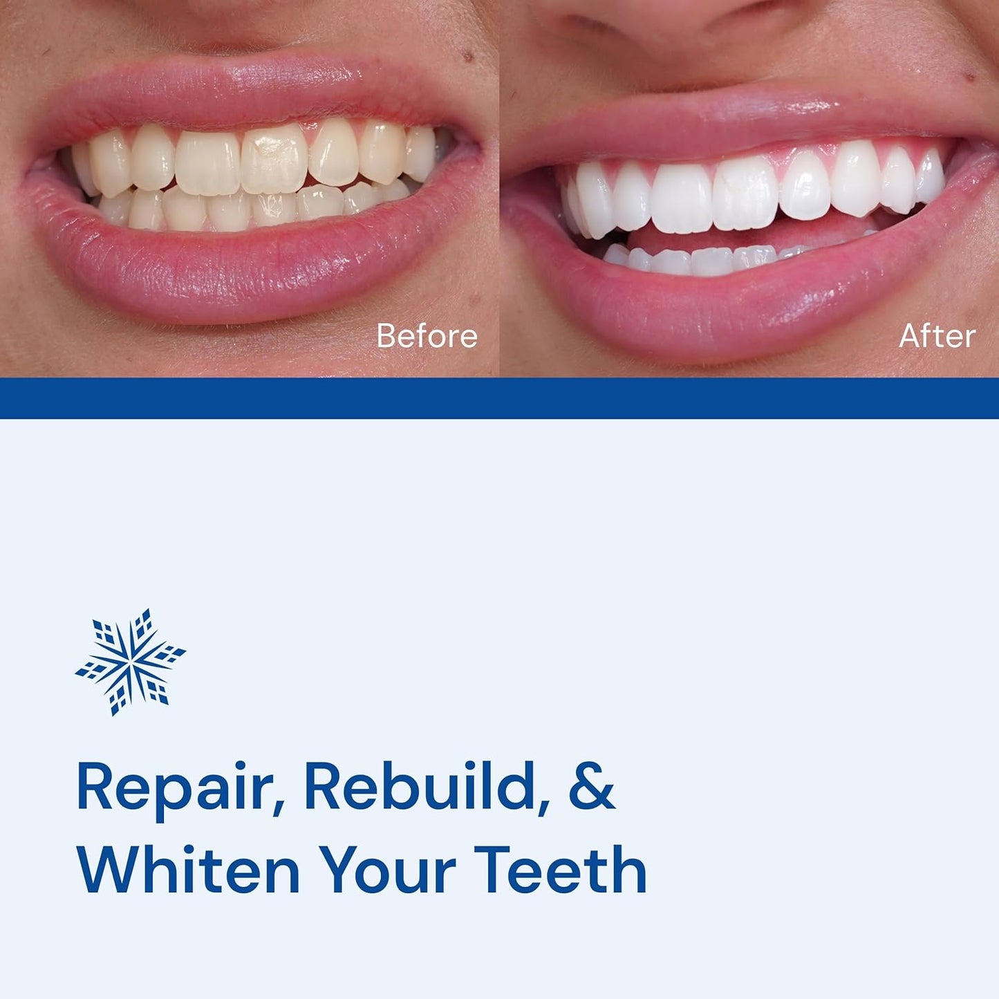 Snow Teeth Whitening Kit - Snow Teeth Whitening Serum and LED Mouthpiece Whitener, Formulated with Hydroxyapatite, Good for 2 Months - Wired Kit with 1 Wand