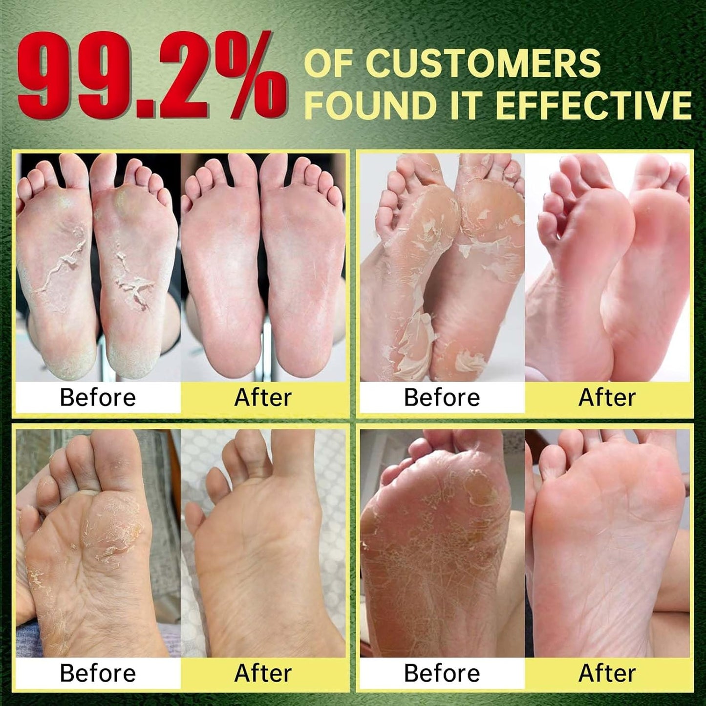 Foot Peeling Mask, Natural Exfoliating Foot Mask, Dead Skin Callus Remover Repair Heels, Hydrating Foot Care for Dry Cracked Feet（3 PacK）