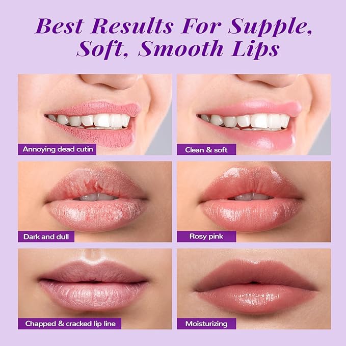 ANAI RUI Lip Therapy Set, Lip Scrub & Lip Mask, Overnight Hydrating Lip Moisturizer with Lip Exfoliator Scrub and Lip Sleeping Mask for Lip Plumping, Lip Gift Kit for Dry, Chapped, Dark Lips, Grape