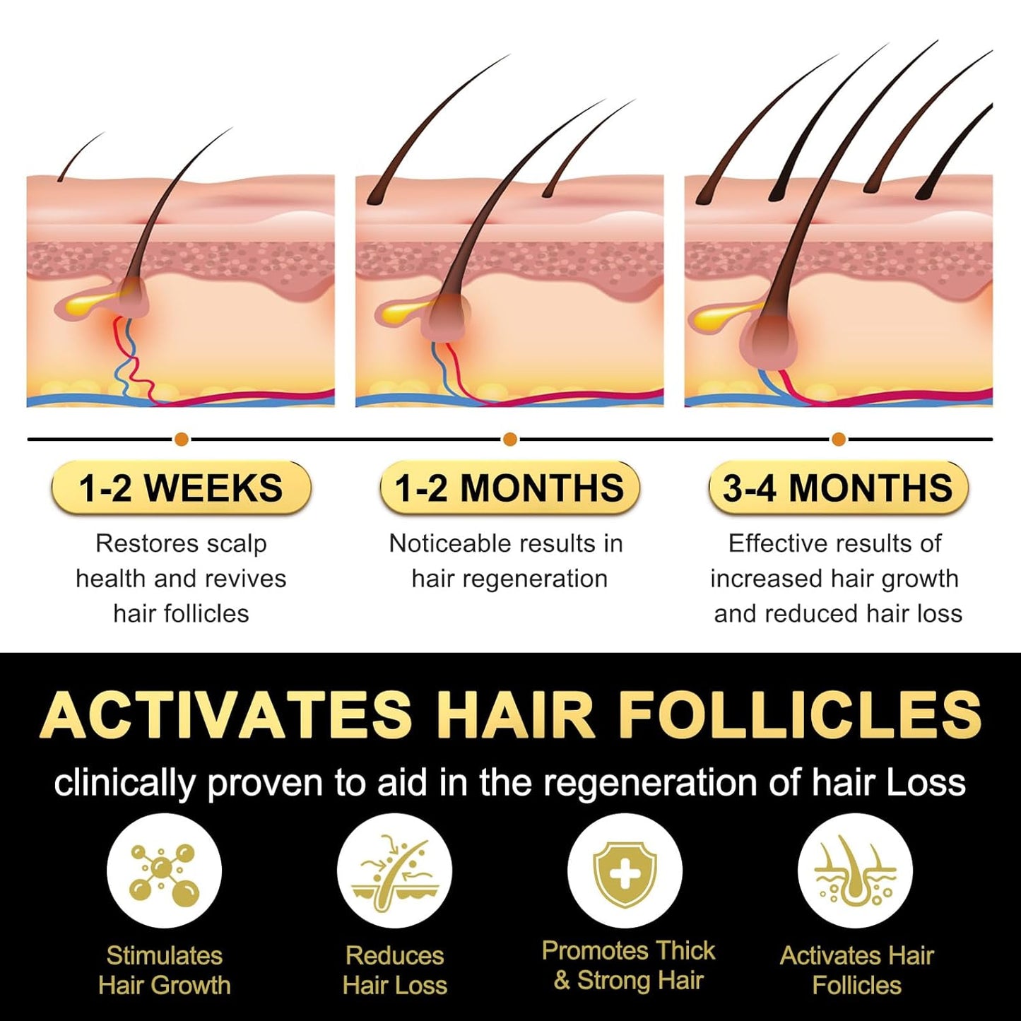 5% Minoxidil for Men and Women Hair Growth Serum, Biotin Hair Growth, Hair Regrowth Treatment for Scalp Hair Loss Hair Thinning for Thicker Longer Fuller Healthier Hair (Pack of 2)