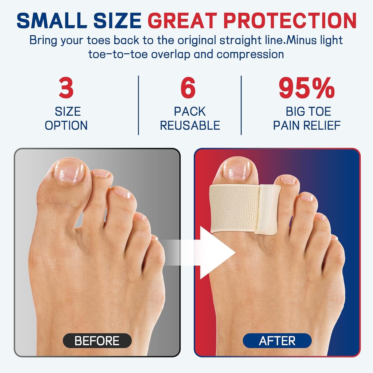 Big Toe Spacers,Hallux Valgus Corrector,Relieve Bunion Pain,Prevent Overlapping Toes, All-Day Comfort for Men & Women, Fits in Shoes.