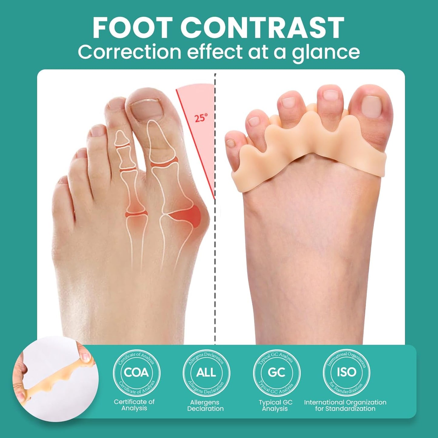 Welnove Toe Separators Bunion Corrector - Toe Spacers for Men Women to Correct Bunions and Relieve Foot Pain - Silicone Toe Spacers for Toe Overlapping Hammertoe Yoga Practice - Beige,8 Pack