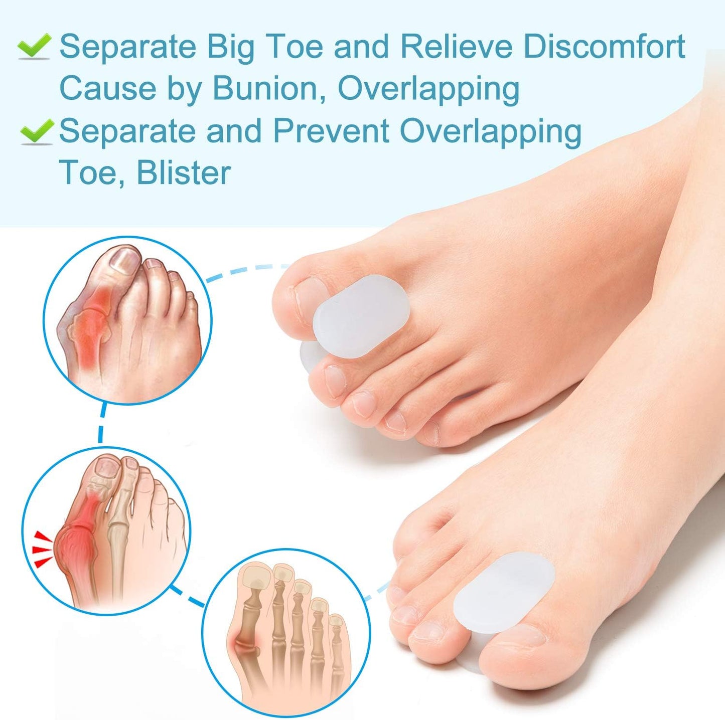 Povihome 10 Pack Toe Spacers Separators, Bunion Corrector Gel Orthotics (1/2'' Thick) for Bunion, Overlapping Toes - L Size