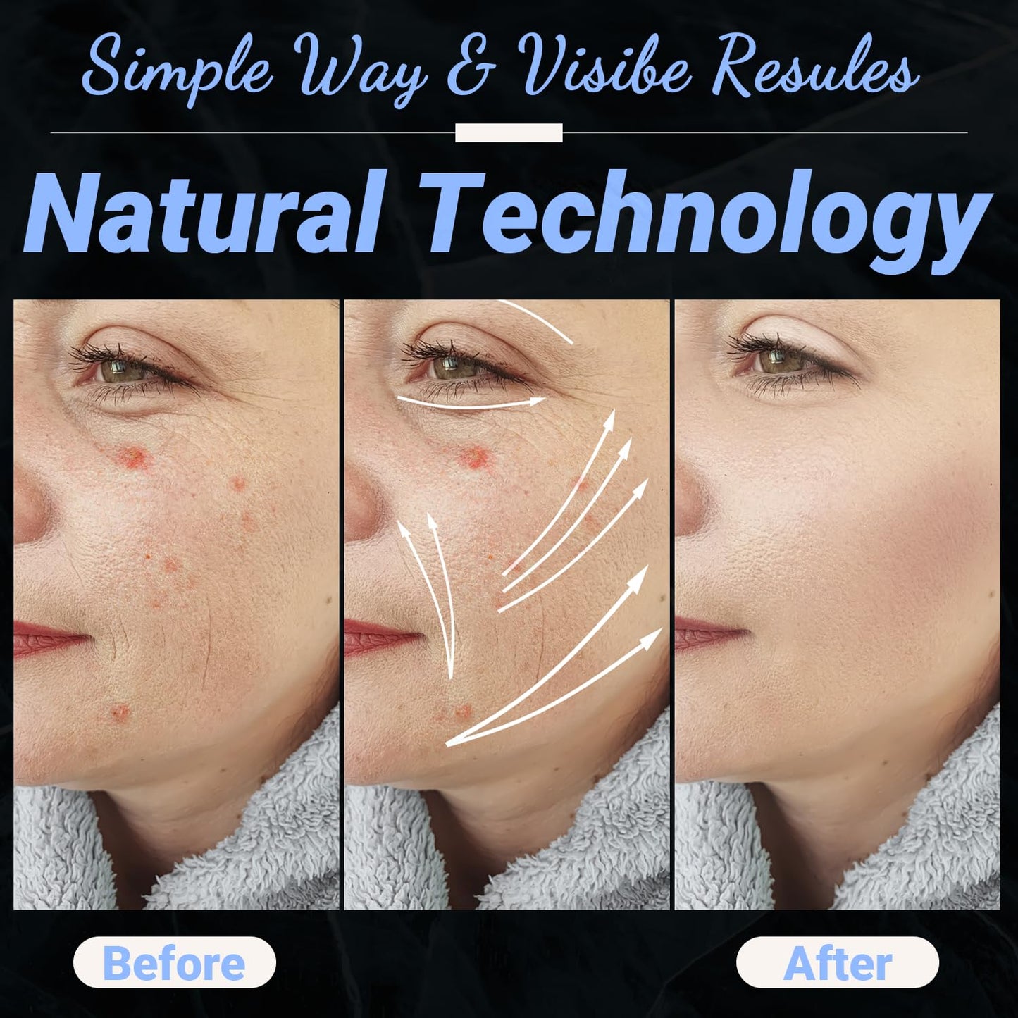 High Frequency Facial Wand - UUPAS Portable Handheld 4 in 1 Blue High Frequency Skin Facial Machine with 4 Pcs Different Blue Tubes for Home Use Face Device