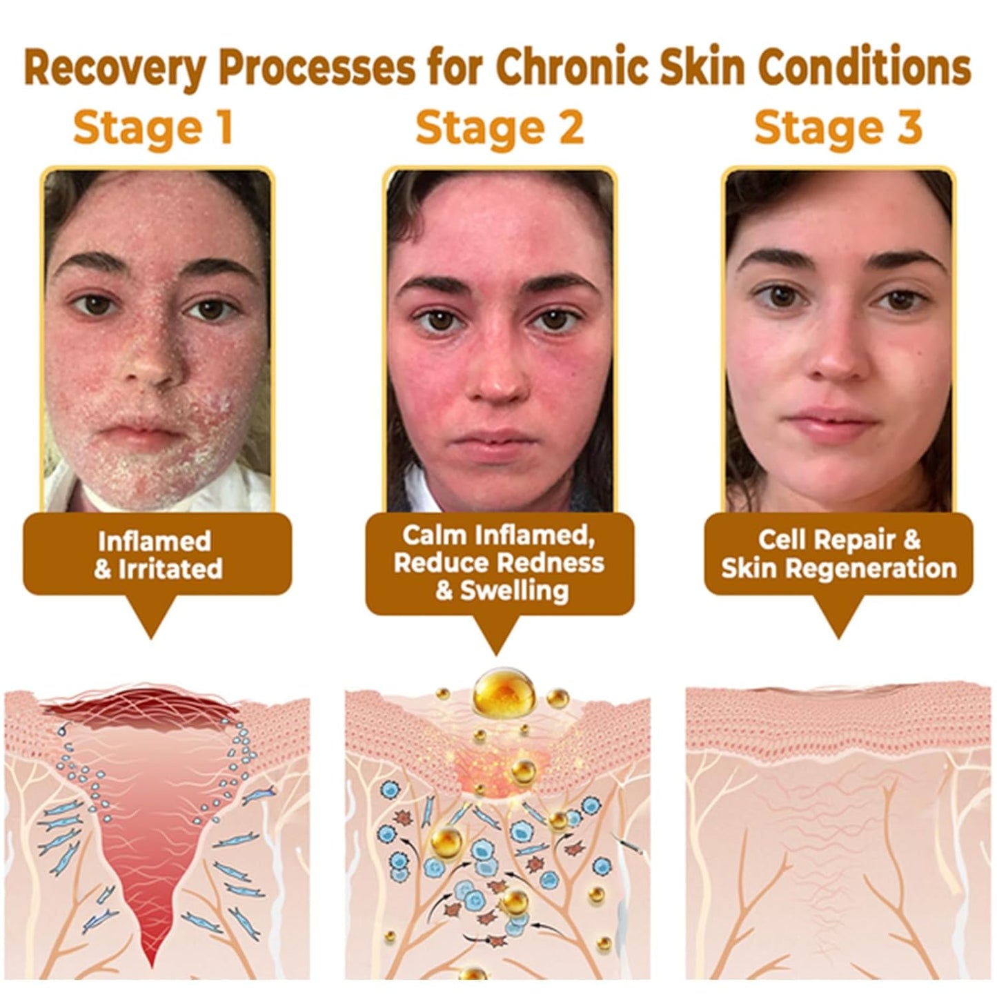 LipMaps Bee Venom Skin Restoration Cream, Bee Venom Skin Treatment Cream, Repair skin and Firming, Effective In Reducing Blemishes (1)