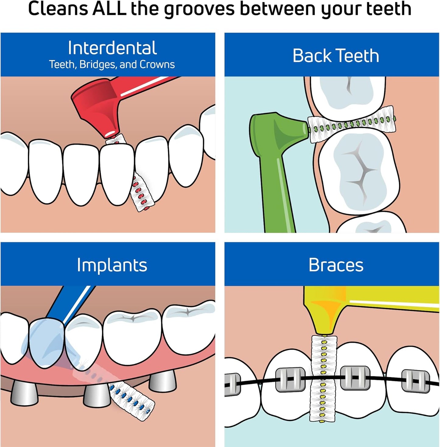 TePe Interdental Brush Angle, Angled Dental Brush for Teeth Cleaning, Pack of 25, 0.7 mm, Medium Gaps, Yellow, Size 4
