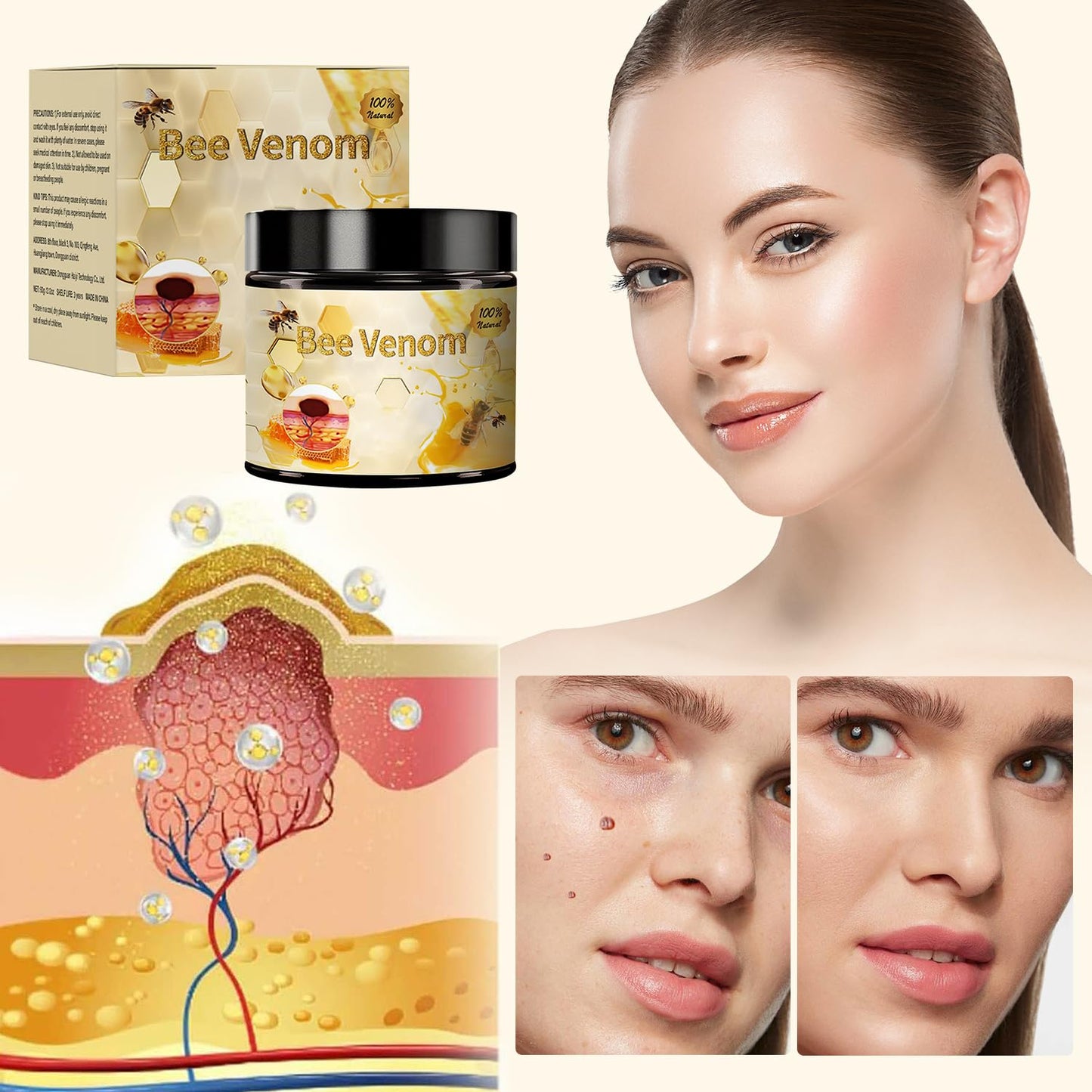2pcs Bee Venom Treatment, New Professional Bee Venom Repair Cream, Bee Venom Cream for All Body Parts