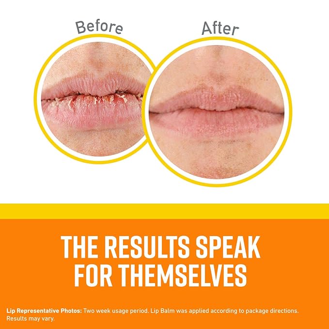 O'Keeffe's Lip Repair SPF 35 Lip Balm Stick, (Pack of 1)