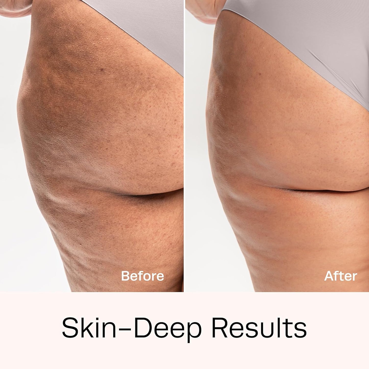 Hot Vita Retinol Body Toner - Nighttime Anti-Aging & Anti-Cellulite Formula to Tighten Skin, Smooth Complexion, & Enhance Radiance - Body Serum for Women - Made with Natural, Skin-Safe Ingredients