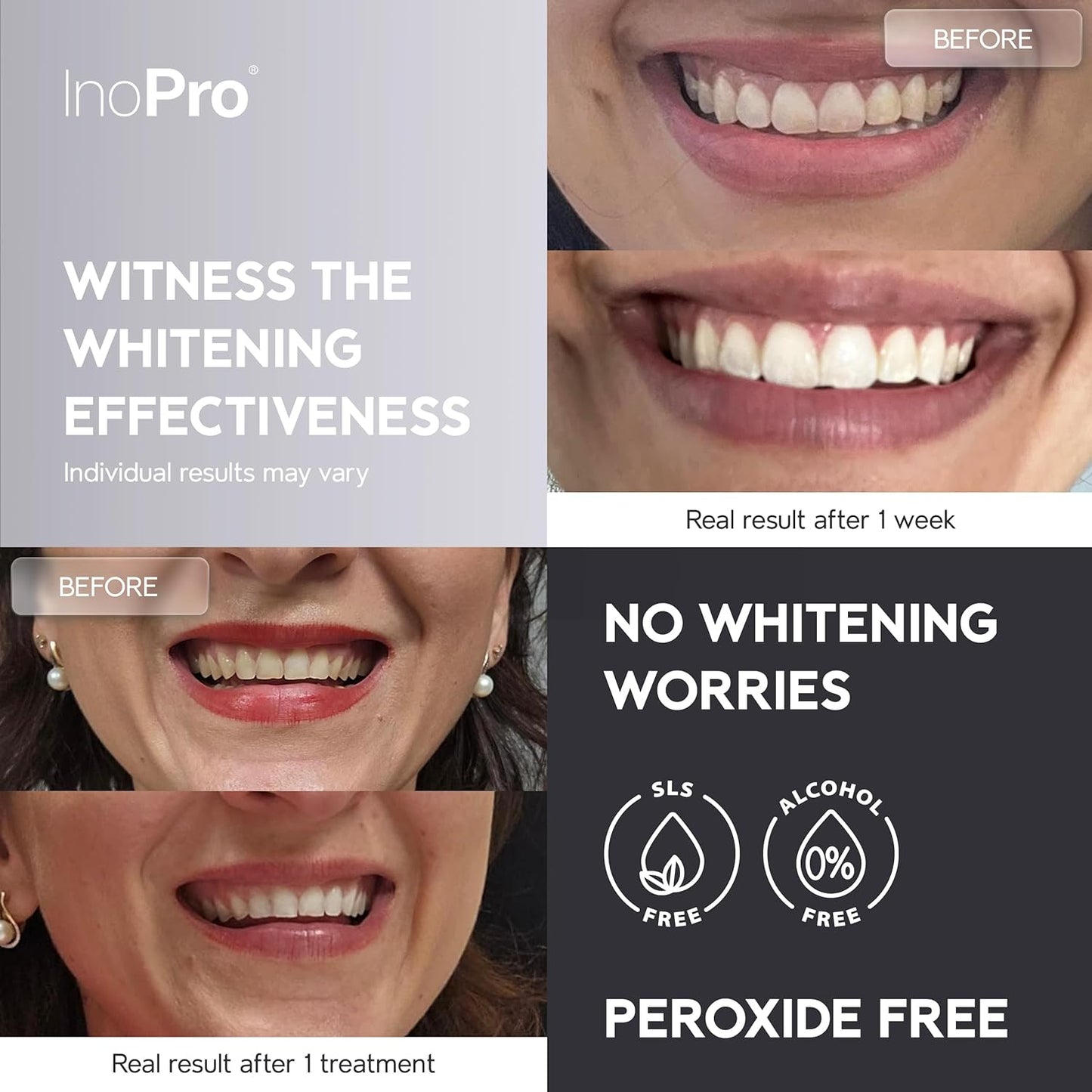Natural Teeth Whitening Strips Kit 14 Treatments - Sensitive Teeth Whitener, Peroxide Free with Papain, Bromelain, Coconut Oil, White Strips for Teeth Whitening (28 Strips)