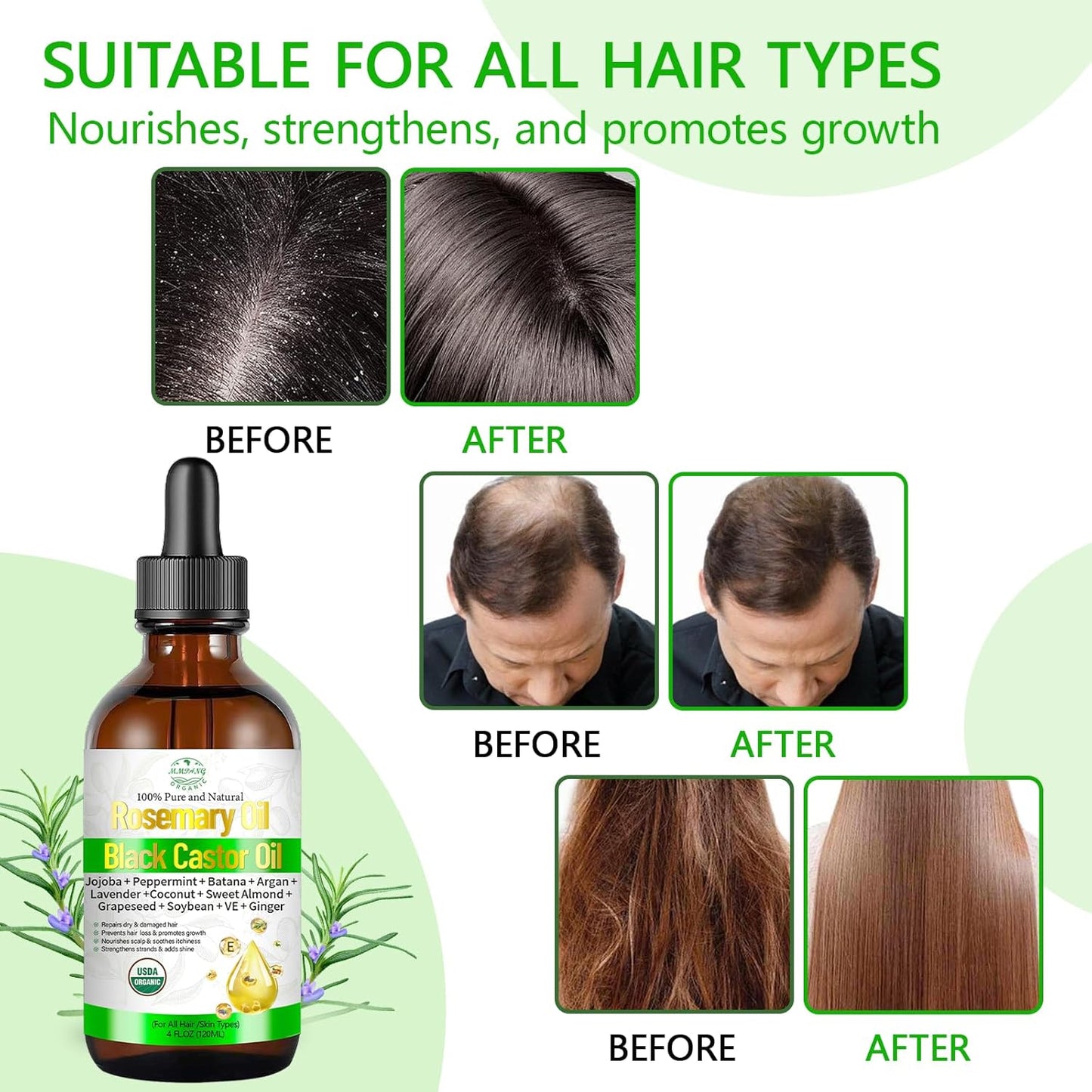 Rosemary Oil for Hair Growth with Castor, Organic Cold Pressed Blend Hair Oil Natural Scalp Care - Soothes Itchy Scalp, Repairs Dry Hair & Nourishes Roots for All Hair Types - 4 Fl Oz